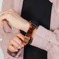 Resin Marble Tortoiseshell Apple Watch Band Marble Style Apple Watch