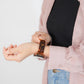 Resin Marble Tortoiseshell Apple Watch Band Marble Style Apple Watch
